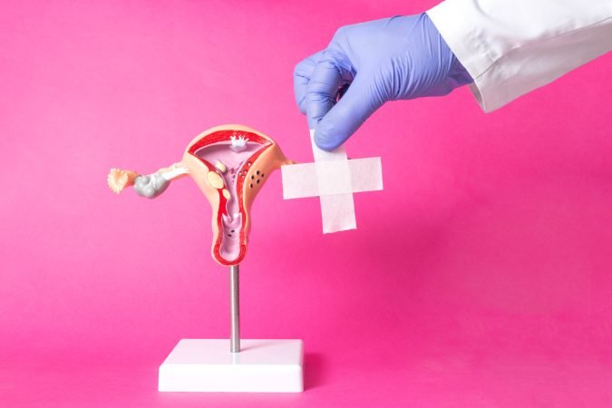 Cervical Cancer treatment in Mulund