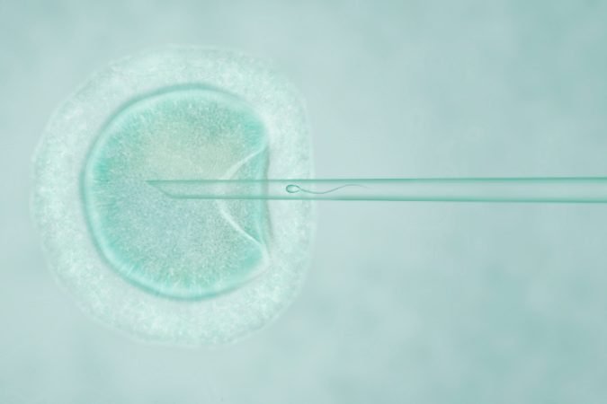 ICSI Fertility Treatment